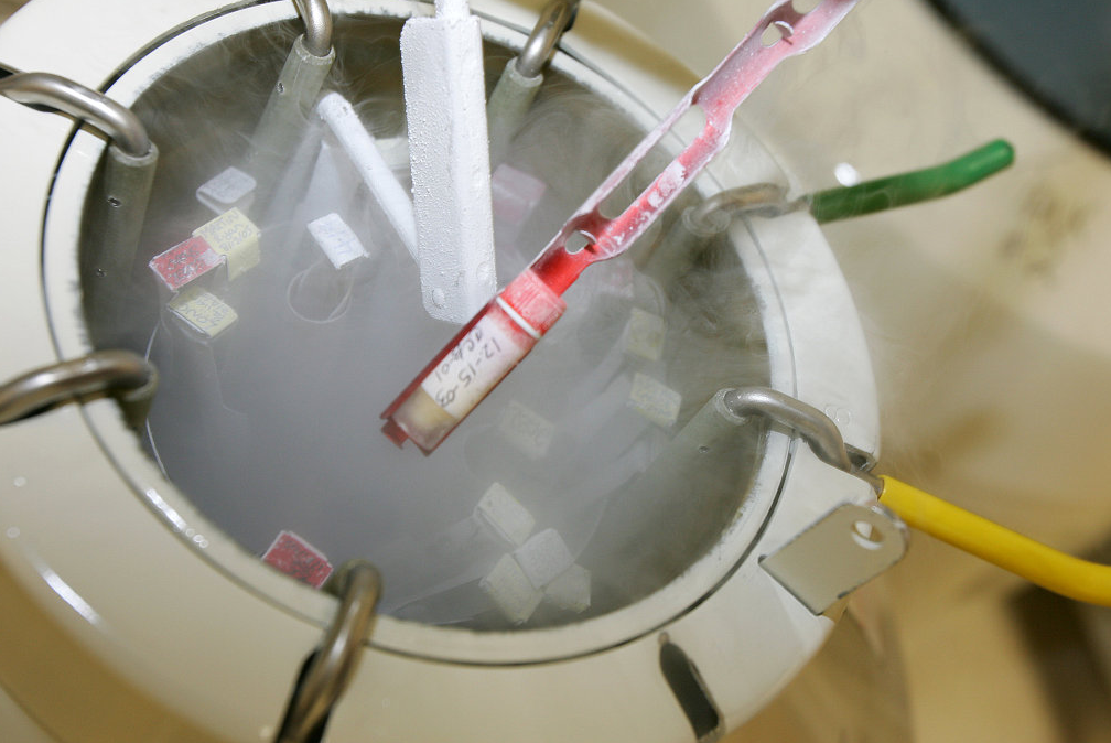 凍存管凍存 凍存管凍存